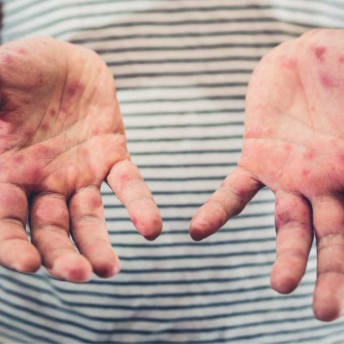 Washington DC Biohazard & Crime Cleanup Services Washington DC Biohazard & Crime Cleanup Services